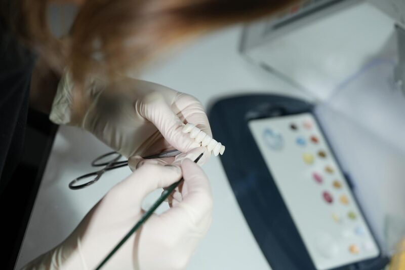 Diş Beyazlatma - Zürih Diş Gebze